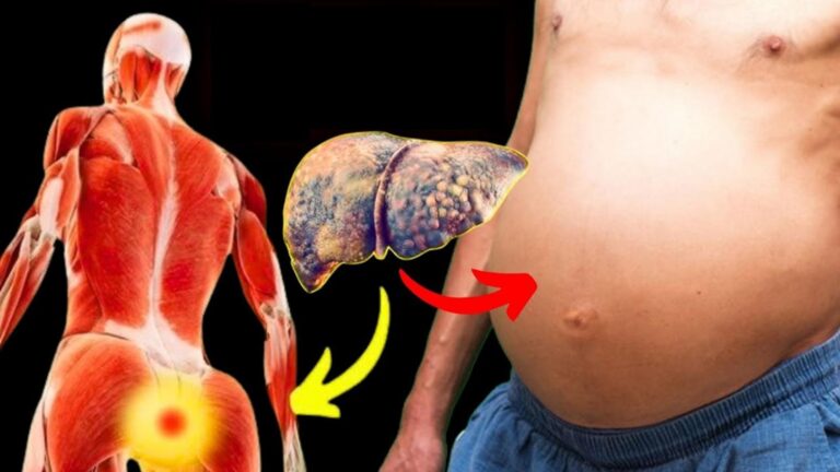 10 objawów chorej wątroby, które mogą zaskoczyć – sprawdź je teraz!